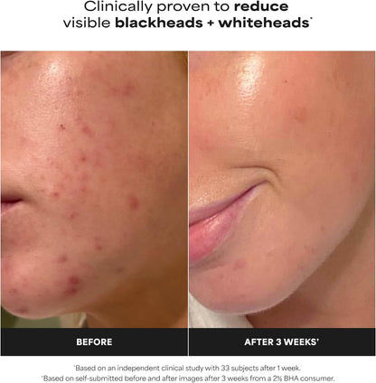 Paulas Choice SKIN PERFECTING 2%