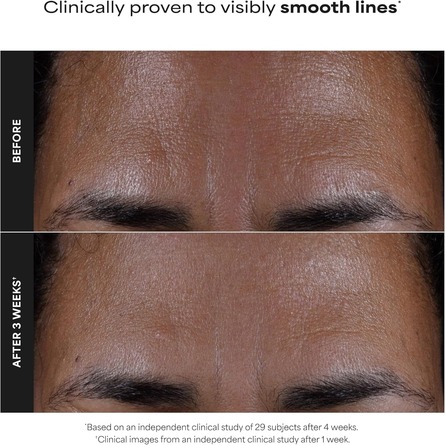 Paulas Choice SKIN PERFECTING 2%