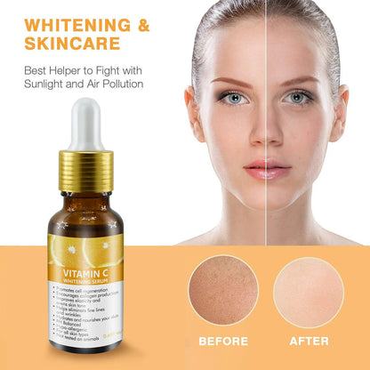 30mL Vitamin C & E Facial Skin Brightening Serum