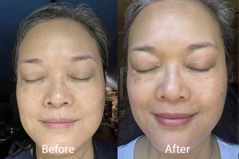 Spot-Fading Peel-Off Mask – Brighten, Cleanse & Tighten Pores